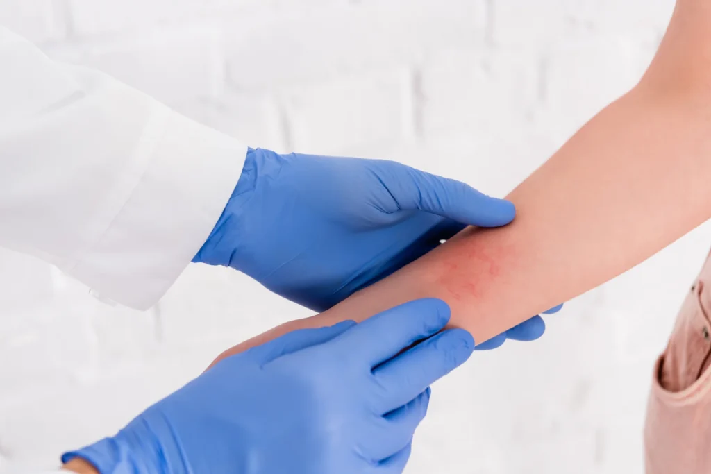 doctor examines child s arm rash in clinical setti 2026 03 11 04 14 34 utc