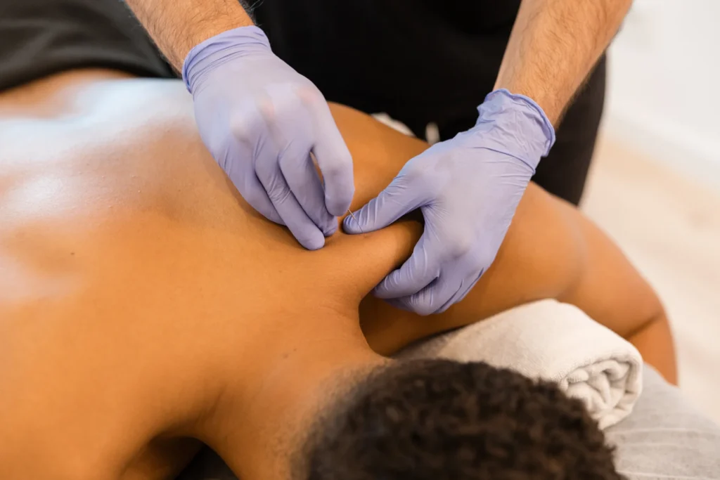 practitioner performing dry needling therapy on a 2026 08 19 17 23 49 utc