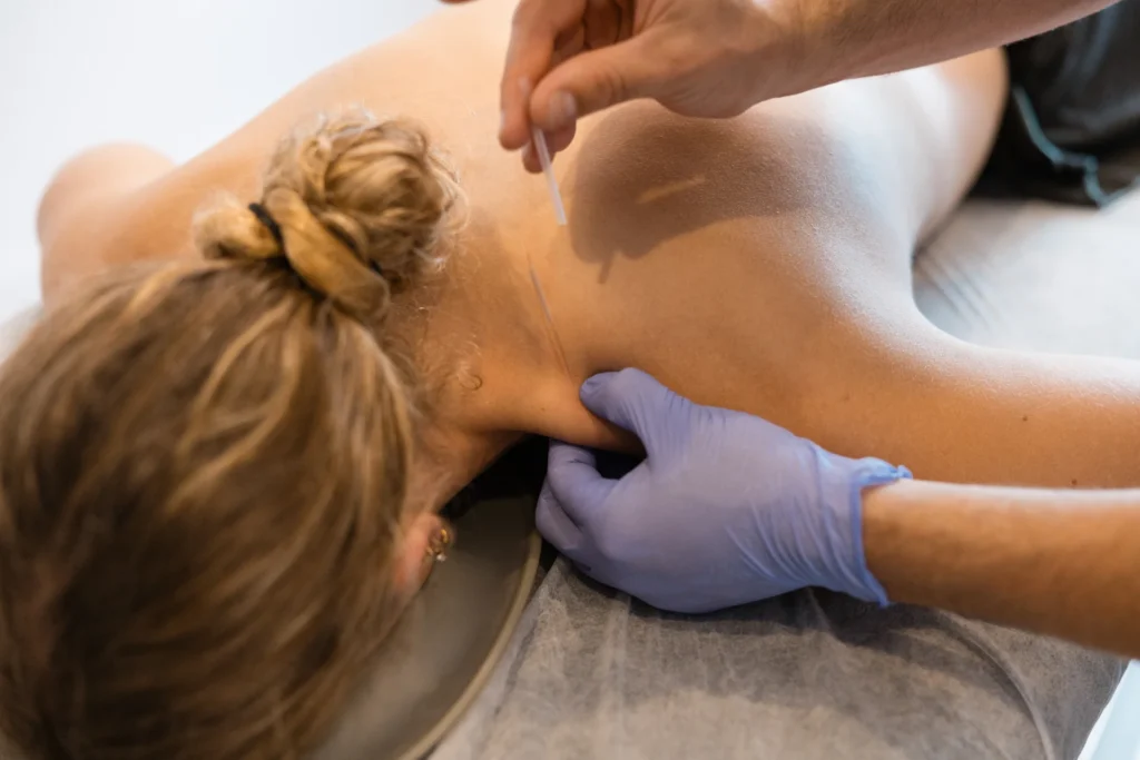 professional practitioner performing dry needling 2026 08 19 17 04 30 utc